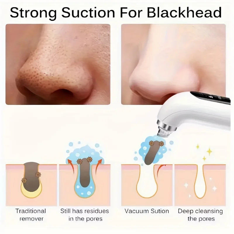Blackhead Vacuum Suction Tool Kit, 6 Tips 3 Levels, USB Rechargeable - Portable Facial Pore Cleaner