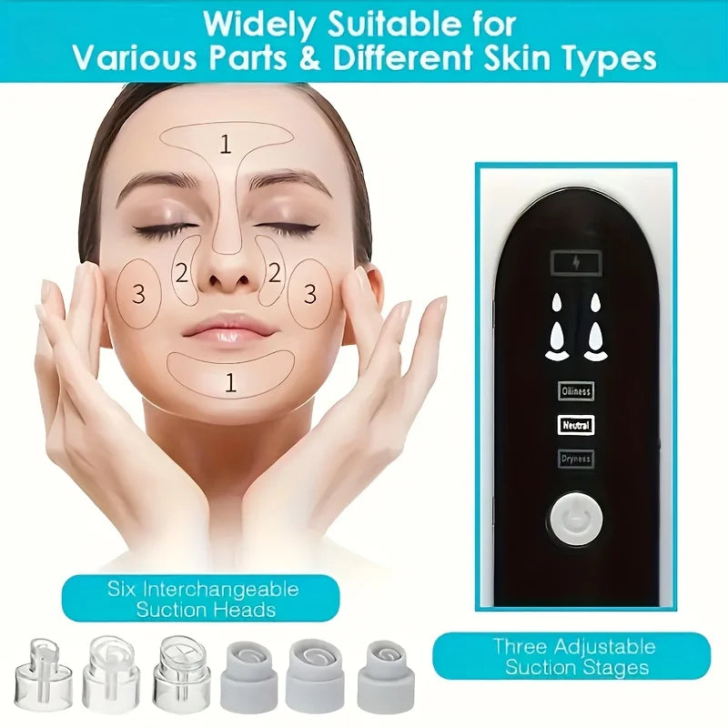 Blackhead Vacuum Suction Tool Kit, 6 Tips 3 Levels, USB Rechargeable - Portable Facial Pore Cleaner